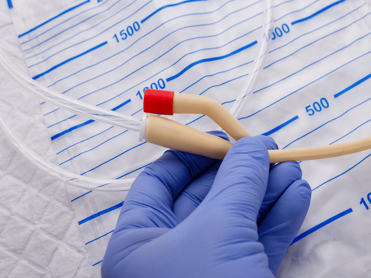 Çin Menşeli Kateter İthalatına Damping Soruşturması Açıldı